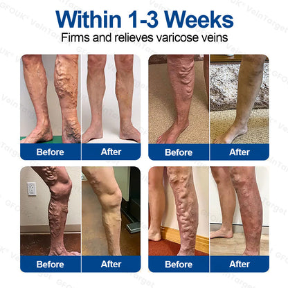✅𝐅𝐥𝐨𝐫𝐢𝐬𝐦𝐚® 🩸🩸𝐕𝐞𝐢𝐧𝐓𝐚𝐫𝐠𝐞𝐭 𝐌𝐢𝐜𝐫𝐨𝐧𝐞𝐞𝐝𝐥𝐞 𝐏𝐚𝐭𝐜𝐡⚡Instant Relief, Long-Term Results
