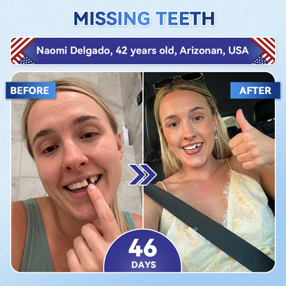 🦷𝐆𝐥𝐢𝐦𝐦𝐞𝐫𝐥𝐲®📟🚀𝐓𝐢𝐝𝐞𝐠𝐥𝐮𝐬𝐢𝐛 𝐓𝐨𝐨𝐭𝐡 & 𝐆𝐮𝐦 𝐑𝐞𝐩𝐚𝐢𝐫 𝐌𝐢𝐜𝐫𝐨𝐧𝐞𝐞𝐝𝐥𝐞 𝐏𝐚𝐭𝐜𝐡  | 𝐀𝐝𝐯𝐚𝐧𝐜𝐞𝐝 𝐒𝐭𝐞𝐦-𝐂𝐞𝐥𝐥 𝐀𝐜𝐭𝐢𝐯𝐚𝐭𝐢𝐨𝐧 𝐓𝐞𝐞𝐭𝐡 𝐒𝐭𝐫𝐢𝐩𝐬(🦷𝐑𝐞𝐛𝐮𝐢𝐥𝐝 𝐄𝐧𝐚𝐦𝐞𝐥 & 𝐃𝐞𝐧𝐭𝐢𝐧 • 𝐒𝐭𝐫𝐞𝐧𝐠𝐭𝐡𝐞𝐧 𝐆𝐮𝐦𝐬 • 𝐄𝐫𝐚𝐝𝐢𝐜𝐚𝐭𝐞 𝐓𝐚𝐫𝐭𝐚𝐫 & 𝐎𝐝𝐨𝐫 • 𝐒𝐭𝐨𝐩 𝐓𝐨𝐨𝐭𝐡 𝐒𝐞𝐧𝐬𝐢𝐭𝐢𝐯𝐢𝐭𝐲)