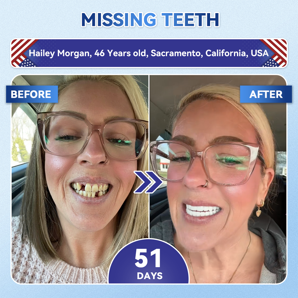 🦷𝐆𝐥𝐢𝐦𝐦𝐞𝐫𝐥𝐲®📟🚀𝐓𝐢𝐝𝐞𝐠𝐥𝐮𝐬𝐢𝐛 𝐓𝐨𝐨𝐭𝐡 & 𝐆𝐮𝐦 𝐑𝐞𝐩𝐚𝐢𝐫 𝐌𝐢𝐜𝐫𝐨𝐧𝐞𝐞𝐝𝐥𝐞 𝐏𝐚𝐭𝐜𝐡  | 𝐀𝐝𝐯𝐚𝐧𝐜𝐞𝐝 𝐒𝐭𝐞𝐦-𝐂𝐞𝐥𝐥 𝐀𝐜𝐭𝐢𝐯𝐚𝐭𝐢𝐨𝐧 𝐓𝐞𝐞𝐭𝐡 𝐒𝐭𝐫𝐢𝐩𝐬(🦷𝐑𝐞𝐛𝐮𝐢𝐥𝐝 𝐄𝐧𝐚𝐦𝐞𝐥 & 𝐃𝐞𝐧𝐭𝐢𝐧 • 𝐒𝐭𝐫𝐞𝐧𝐠𝐭𝐡𝐞𝐧 𝐆𝐮𝐦𝐬 • 𝐄𝐫𝐚𝐝𝐢𝐜𝐚𝐭𝐞 𝐓𝐚𝐫𝐭𝐚𝐫 & 𝐎𝐝𝐨𝐫 • 𝐒𝐭𝐨𝐩 𝐓𝐨𝐨𝐭𝐡 𝐒𝐞𝐧𝐬𝐢𝐭𝐢𝐯𝐢𝐭𝐲)