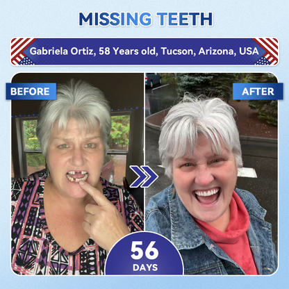 🦷𝐆𝐥𝐢𝐦𝐦𝐞𝐫𝐥𝐲®📟🚀𝐓𝐢𝐝𝐞𝐠𝐥𝐮𝐬𝐢𝐛 𝐓𝐨𝐨𝐭𝐡 & 𝐆𝐮𝐦 𝐑𝐞𝐩𝐚𝐢𝐫 𝐌𝐢𝐜𝐫𝐨𝐧𝐞𝐞𝐝𝐥𝐞 𝐏𝐚𝐭𝐜𝐡  | 𝐀𝐝𝐯𝐚𝐧𝐜𝐞𝐝 𝐒𝐭𝐞𝐦-𝐂𝐞𝐥𝐥 𝐀𝐜𝐭𝐢𝐯𝐚𝐭𝐢𝐨𝐧 𝐓𝐞𝐞𝐭𝐡 𝐒𝐭𝐫𝐢𝐩𝐬(🦷𝐑𝐞𝐛𝐮𝐢𝐥𝐝 𝐄𝐧𝐚𝐦𝐞𝐥 & 𝐃𝐞𝐧𝐭𝐢𝐧 • 𝐒𝐭𝐫𝐞𝐧𝐠𝐭𝐡𝐞𝐧 𝐆𝐮𝐦𝐬 • 𝐄𝐫𝐚𝐝𝐢𝐜𝐚𝐭𝐞 𝐓𝐚𝐫𝐭𝐚𝐫 & 𝐎𝐝𝐨𝐫 • 𝐒𝐭𝐨𝐩 𝐓𝐨𝐨𝐭𝐡 𝐒𝐞𝐧𝐬𝐢𝐭𝐢𝐯𝐢𝐭𝐲)