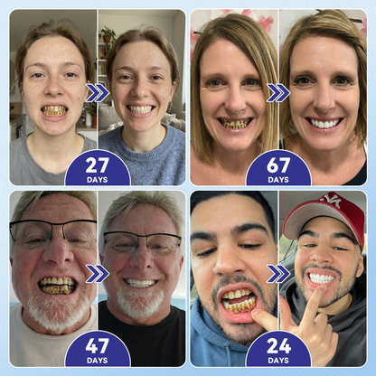 🦷𝐆𝐥𝐢𝐦𝐦𝐞𝐫𝐥𝐲®📟🚀𝐓𝐢𝐝𝐞𝐠𝐥𝐮𝐬𝐢𝐛 𝐓𝐨𝐨𝐭𝐡 & 𝐆𝐮𝐦 𝐑𝐞𝐩𝐚𝐢𝐫 𝐌𝐢𝐜𝐫𝐨𝐧𝐞𝐞𝐝𝐥𝐞 𝐏𝐚𝐭𝐜𝐡  | 𝐀𝐝𝐯𝐚𝐧𝐜𝐞𝐝 𝐒𝐭𝐞𝐦-𝐂𝐞𝐥𝐥 𝐀𝐜𝐭𝐢𝐯𝐚𝐭𝐢𝐨𝐧 𝐓𝐞𝐞𝐭𝐡 𝐒𝐭𝐫𝐢𝐩𝐬(🦷𝐑𝐞𝐛𝐮𝐢𝐥𝐝 𝐄𝐧𝐚𝐦𝐞𝐥 & 𝐃𝐞𝐧𝐭𝐢𝐧 • 𝐒𝐭𝐫𝐞𝐧𝐠𝐭𝐡𝐞𝐧 𝐆𝐮𝐦𝐬 • 𝐄𝐫𝐚𝐝𝐢𝐜𝐚𝐭𝐞 𝐓𝐚𝐫𝐭𝐚𝐫 & 𝐎𝐝𝐨𝐫 • 𝐒𝐭𝐨𝐩 𝐓𝐨𝐨𝐭𝐡 𝐒𝐞𝐧𝐬𝐢𝐭𝐢𝐯𝐢𝐭𝐲)