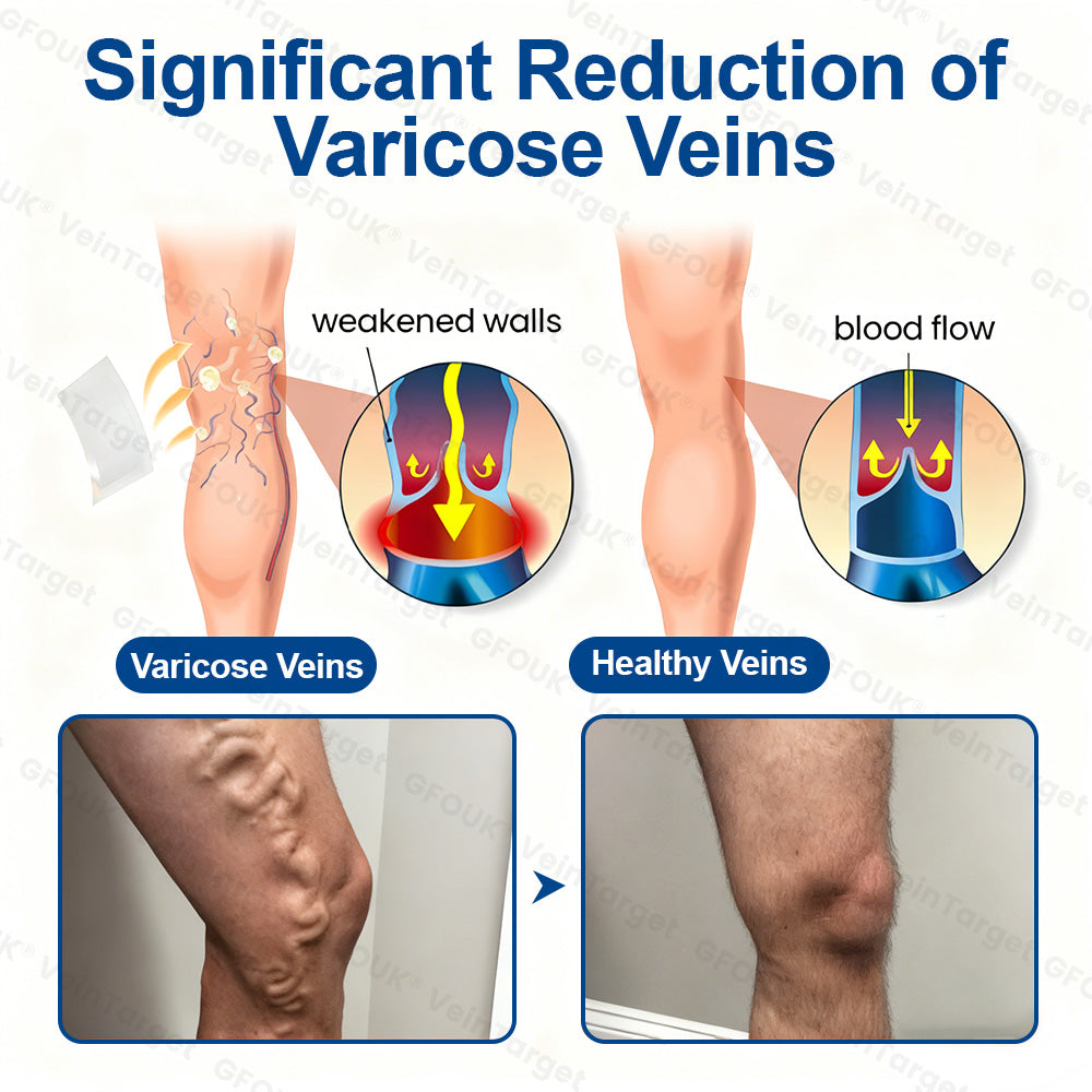 ✅𝐅𝐥𝐨𝐫𝐢𝐬𝐦𝐚® 🩸🩸𝐕𝐞𝐢𝐧𝐓𝐚𝐫𝐠𝐞𝐭 𝐌𝐢𝐜𝐫𝐨𝐧𝐞𝐞𝐝𝐥𝐞 𝐏𝐚𝐭𝐜𝐡⚡Instant Relief, Long-Term Results