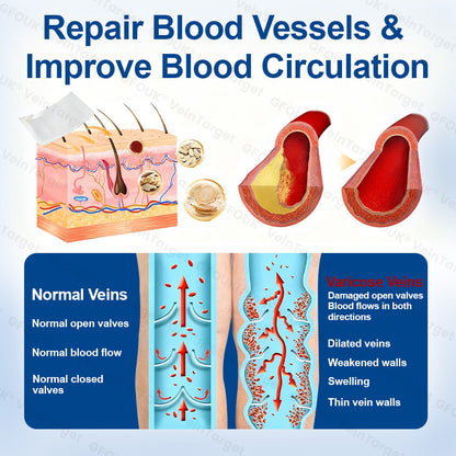 ✅𝐅𝐥𝐨𝐫𝐢𝐬𝐦𝐚® 🩸🩸𝐕𝐞𝐢𝐧𝐓𝐚𝐫𝐠𝐞𝐭 𝐌𝐢𝐜𝐫𝐨𝐧𝐞𝐞𝐝𝐥𝐞 𝐏𝐚𝐭𝐜𝐡⚡Instant Relief, Long-Term Results