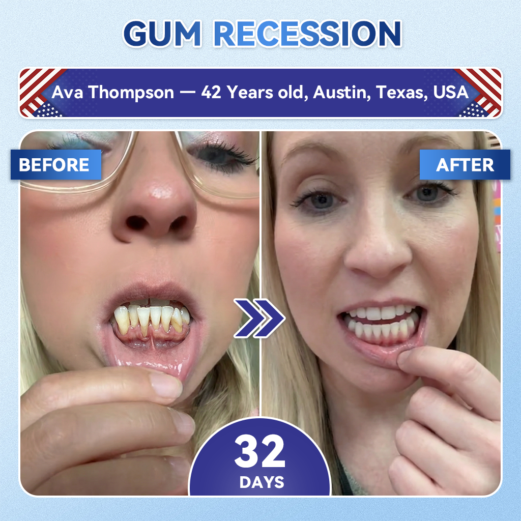 🦷𝐆𝐥𝐢𝐦𝐦𝐞𝐫𝐥𝐲®📟🚀𝐓𝐢𝐝𝐞𝐠𝐥𝐮𝐬𝐢𝐛 𝐓𝐨𝐨𝐭𝐡 & 𝐆𝐮𝐦 𝐑𝐞𝐩𝐚𝐢𝐫 𝐌𝐢𝐜𝐫𝐨𝐧𝐞𝐞𝐝𝐥𝐞 𝐏𝐚𝐭𝐜𝐡  | 𝐀𝐝𝐯𝐚𝐧𝐜𝐞𝐝 𝐒𝐭𝐞𝐦-𝐂𝐞𝐥𝐥 𝐀𝐜𝐭𝐢𝐯𝐚𝐭𝐢𝐨𝐧 𝐓𝐞𝐞𝐭𝐡 𝐒𝐭𝐫𝐢𝐩𝐬(🦷𝐑𝐞𝐛𝐮𝐢𝐥𝐝 𝐄𝐧𝐚𝐦𝐞𝐥 & 𝐃𝐞𝐧𝐭𝐢𝐧 • 𝐒𝐭𝐫𝐞𝐧𝐠𝐭𝐡𝐞𝐧 𝐆𝐮𝐦𝐬 • 𝐄𝐫𝐚𝐝𝐢𝐜𝐚𝐭𝐞 𝐓𝐚𝐫𝐭𝐚𝐫 & 𝐎𝐝𝐨𝐫 • 𝐒𝐭𝐨𝐩 𝐓𝐨𝐨𝐭𝐡 𝐒𝐞𝐧𝐬𝐢𝐭𝐢𝐯𝐢𝐭𝐲)
